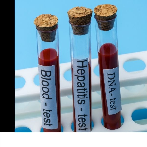 Confidential STD Screening - img2 STD test tubes
